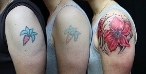टैटू मिटाने के 7 आसान घरेलू उपाय | Tattoo Remove Kaise Kare