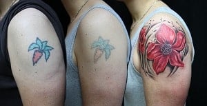 Remedies for Tattoo Removal  टट क नशन हटन क घरल तरक